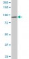 DDX1 Antibody (monoclonal) (M02)